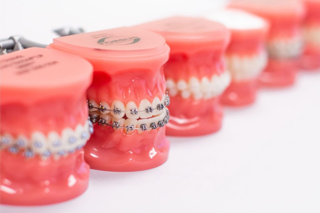 orthodontist milford mi