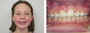 Before & Afters