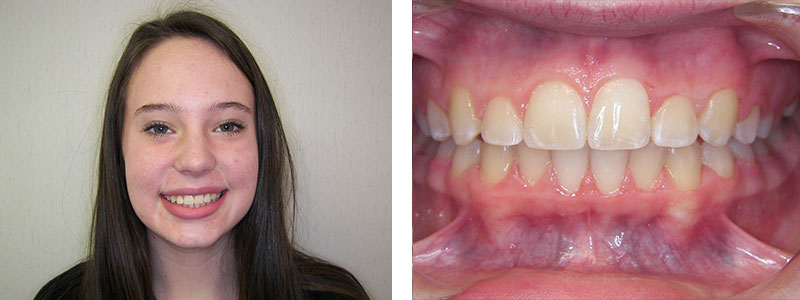 Before & Afters