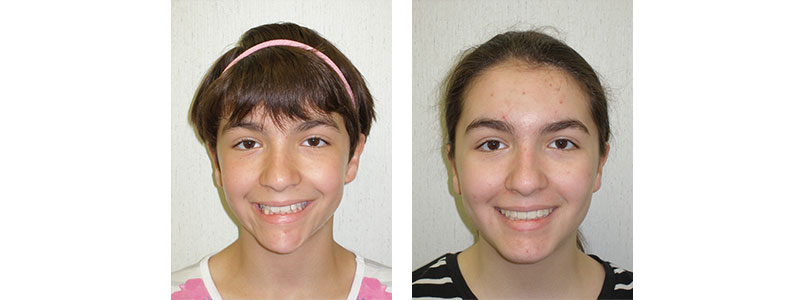 Before & Afters