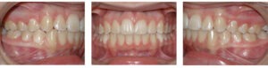 Before & Afters
