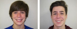 Before & Afters