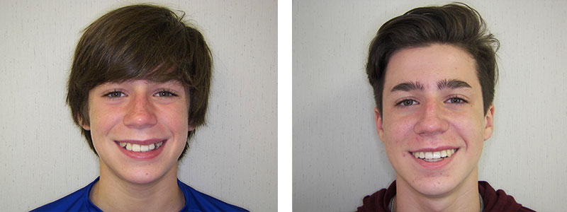 Before & Afters