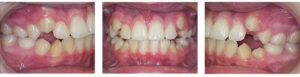 Before & Afters