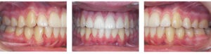 Before & Afters