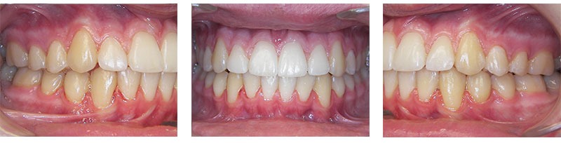Before & Afters