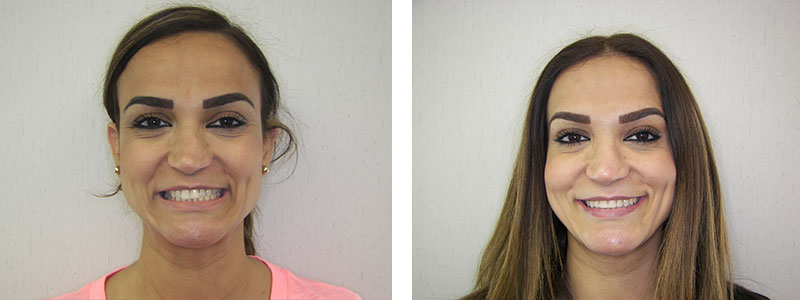 Before & Afters
