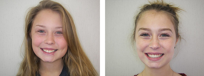 Before & Afters