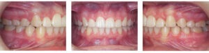 Before & Afters