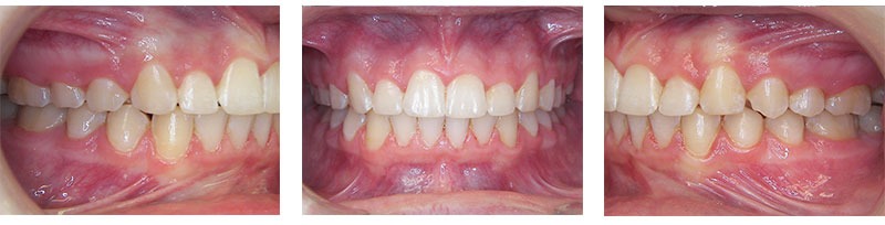Before & Afters
