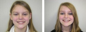 Before & Afters