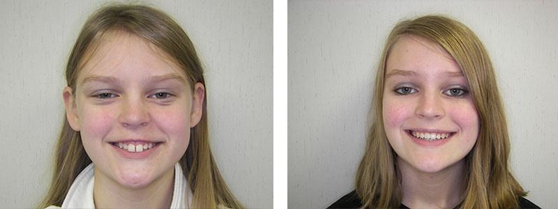 Before & Afters