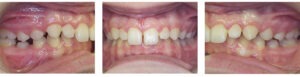 Before & Afters