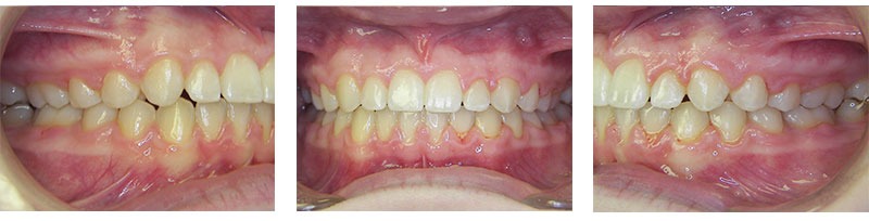 Before & Afters