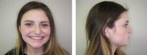 Before & Afters