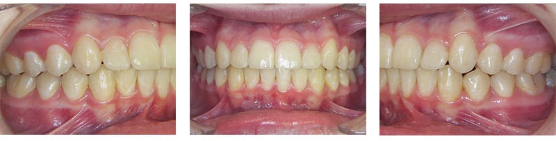 Before & Afters