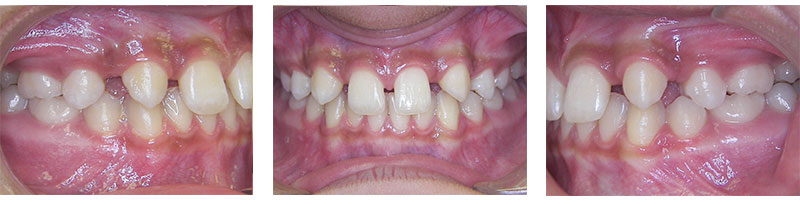Before & Afters
