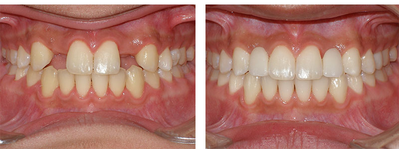 Before & Afters