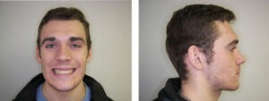 Before & Afters