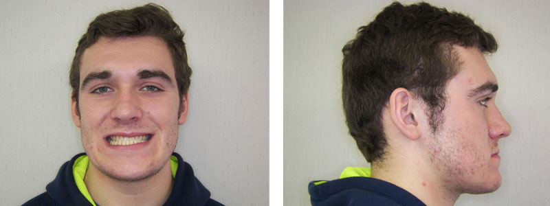 Before & Afters