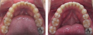Before & Afters