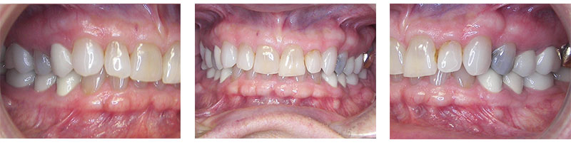 Before & Afters