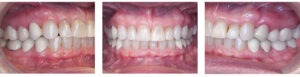 Before & Afters