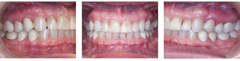 Before & Afters