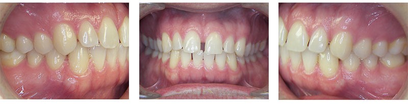 Before & Afters
