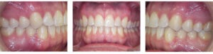 Before & Afters