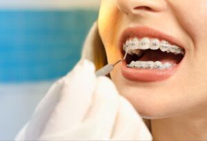 How Orthodontics Can Help Teens Feel Great