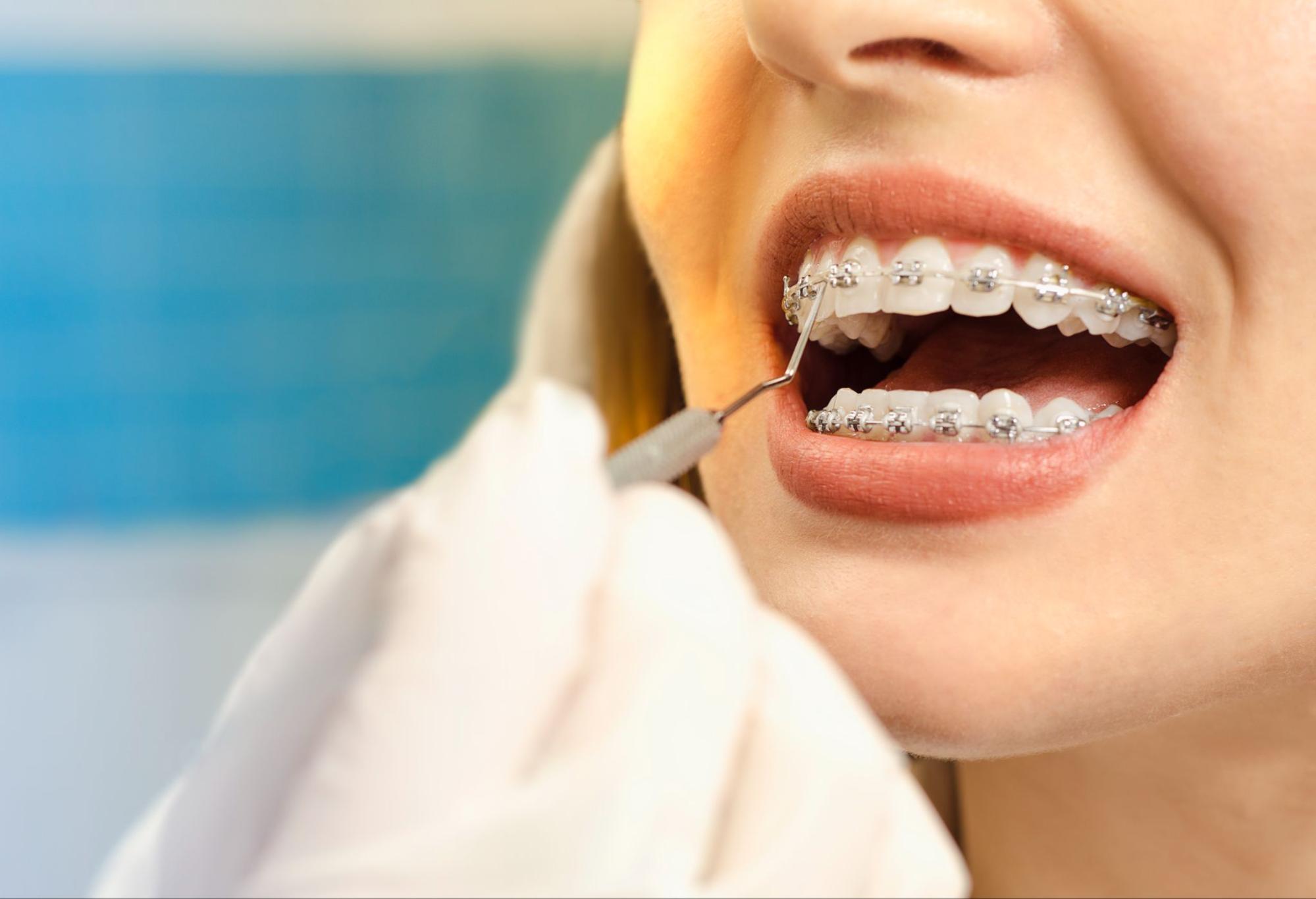 How Orthodontics Can Help Teens Feel Great
