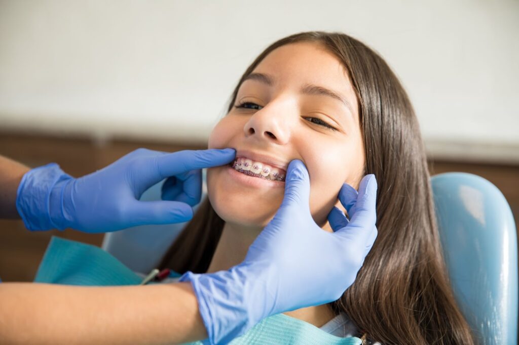 Braces vs. Clear Aligners