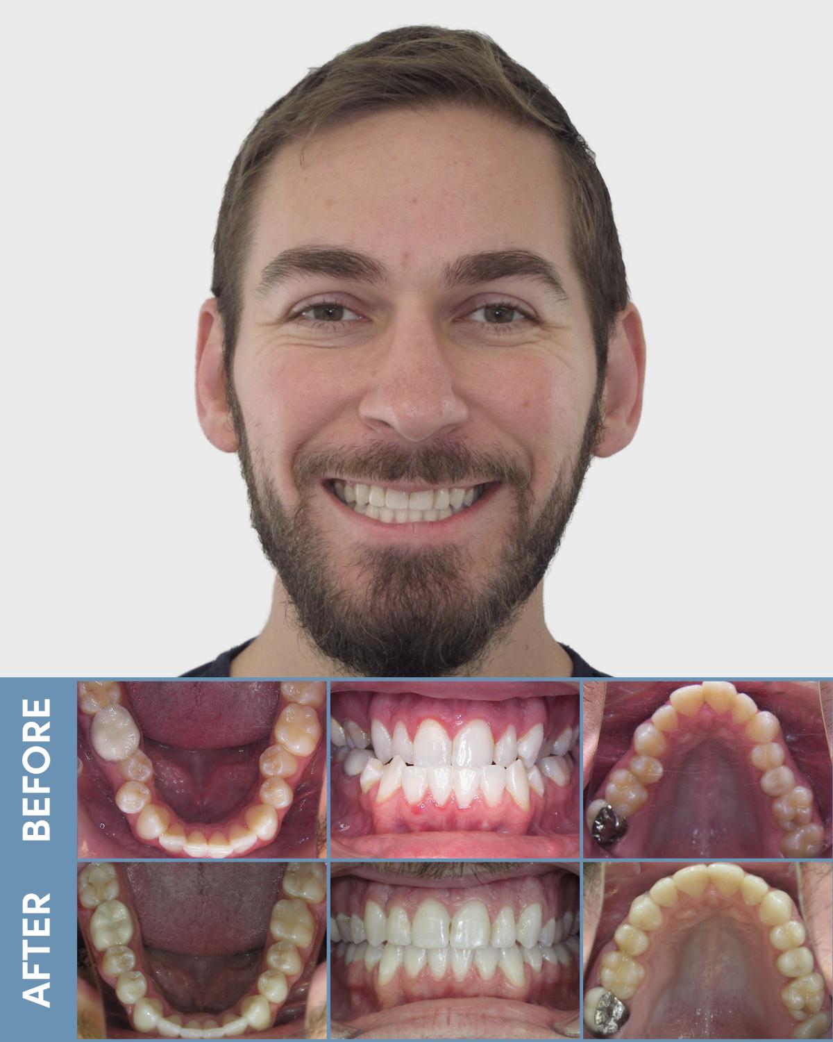 orthodontist birmingham