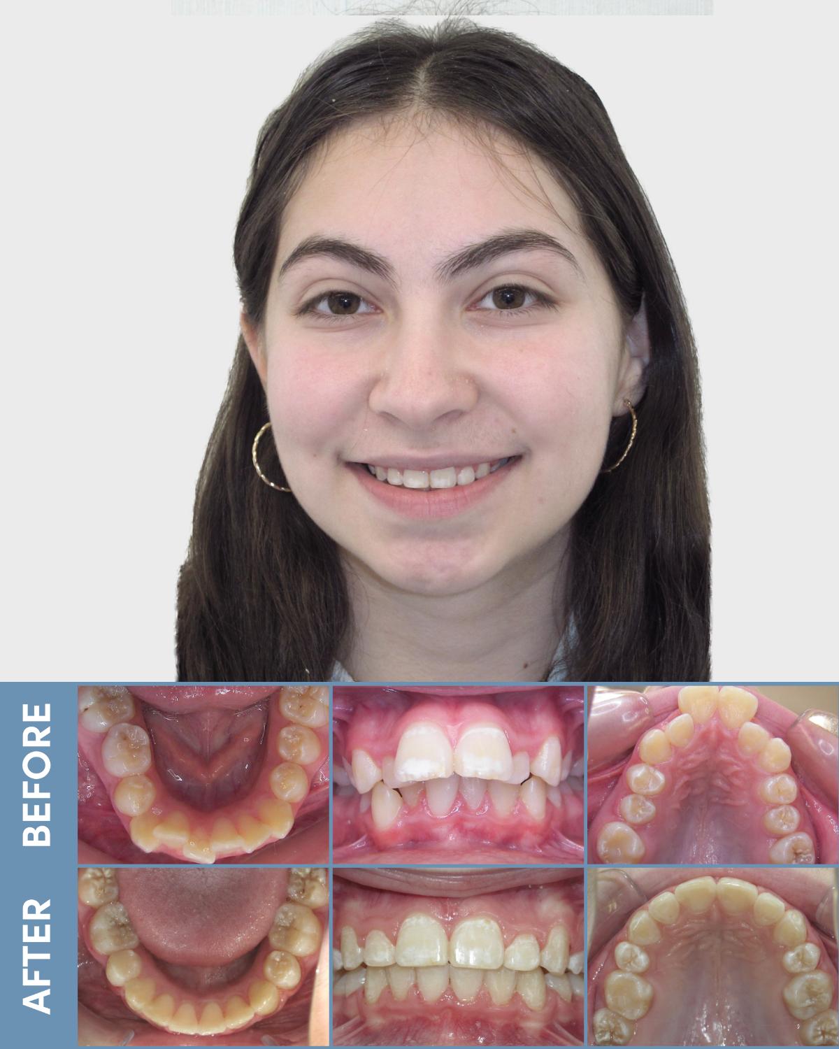 adult man before and after
