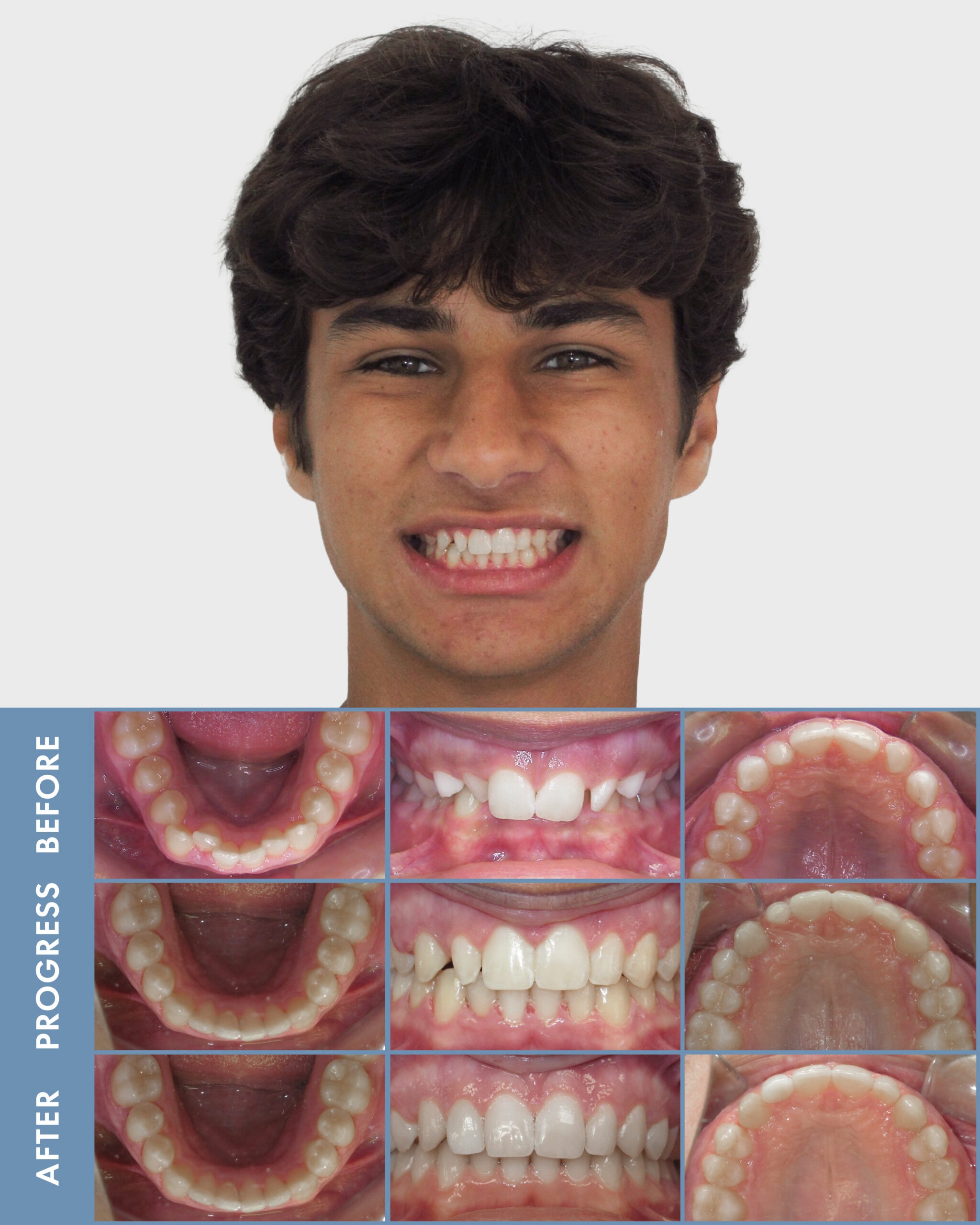 2026-04-20_Degenhardt Ortho_BA Case-Devon Badhwar-Web Graphic-Updated_BG